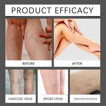 Leg Neck Cream Gentle Relief Discomfort