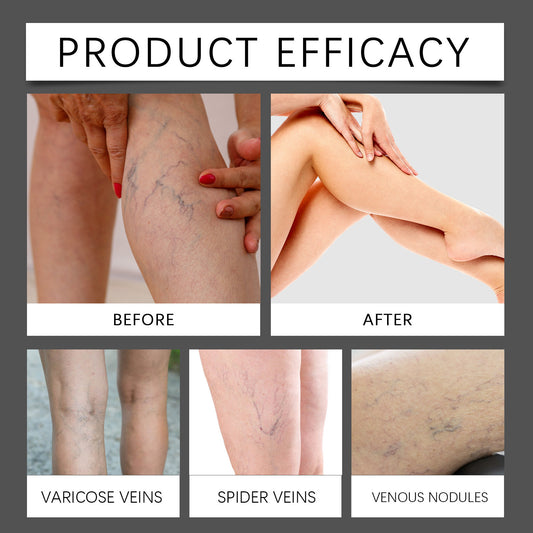 Leg Neck Cream Gentle Relief Discomfort